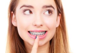 co-nieng-rang-boc-su-duoc-khong3